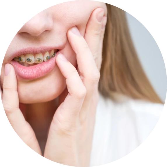 pathologies orthodontiques dr rocca grenobe Pathologies Cabinet d’orthodontie Drs. ROCCA & Associés