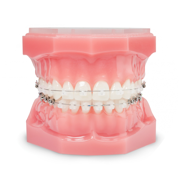 stabilisation position dentaire grenoble  Cabinet d’orthodontie Drs. ROCCA & Associés