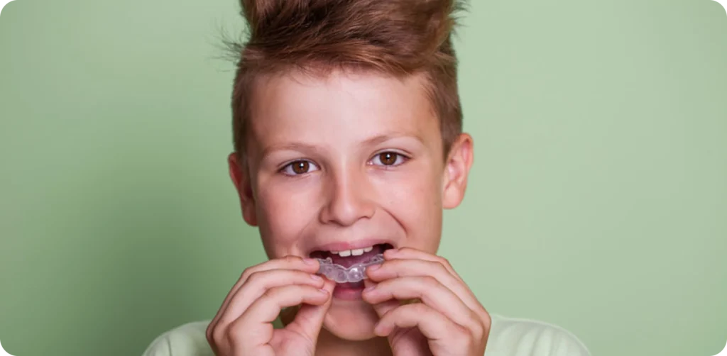 aligneurs invisibles alignement grenoble dents x Aligneurs transparents Cabinet d’orthodontie Drs. ROCCA & Associés