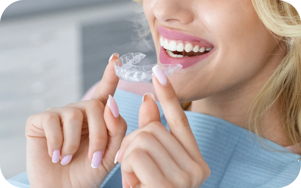 aligneurs invisibles orthodontie adultes dr rocca grenoble Aligneurs invisibles Cabinet d’orthodontie Drs. ROCCA & Associés