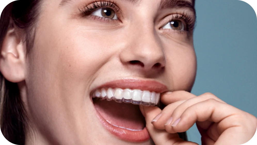 confort aligneurs Aligneurs invisibles Cabinet d’orthodontie Drs. ROCCA & Associés