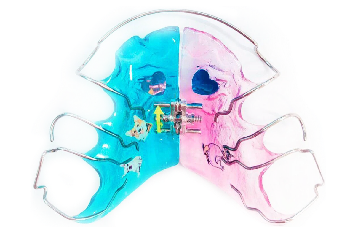 orthodontie adolescents alignement grenoble  Cabinet d’orthodontie Drs. ROCCA & Associés